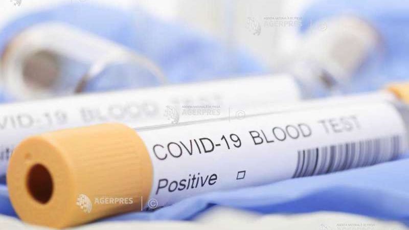 Új algoritmus alapján választják ki, hogy kiken végzik el a koronavírus-tesztet