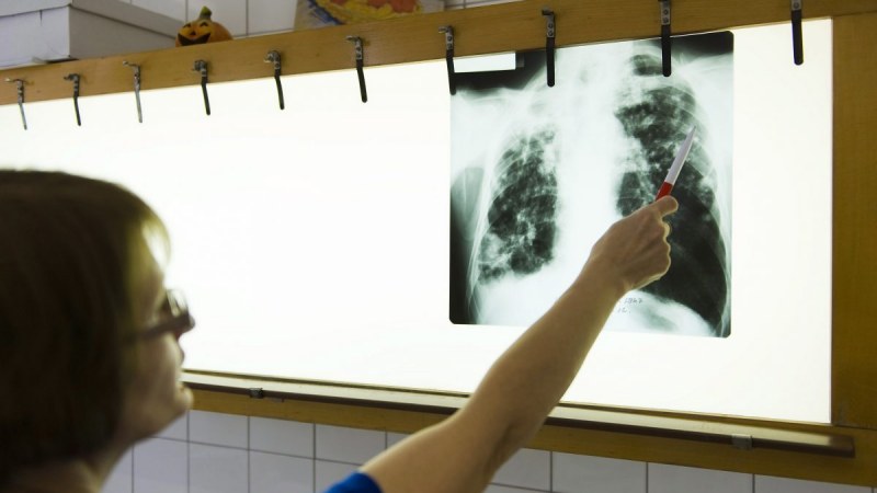 Ingyenes szűrővizsgálatokban részesülhetnek az állami egészségügyi biztosítással rendelkező személyek